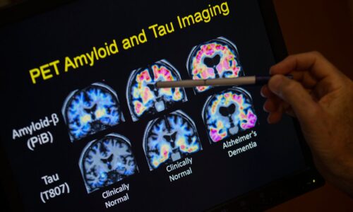 ap_alzheimers_mapping_12082021
